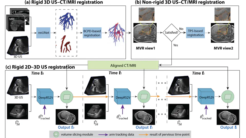 A Novel Framework for Integrating 3D Ultrasound into Percutaneous Liver Tumour Ablation