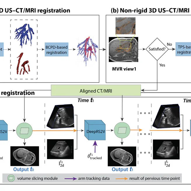 A Novel Framework for Integrating 3D Ultrasound into Percutaneous Liver Tumour Ablation
