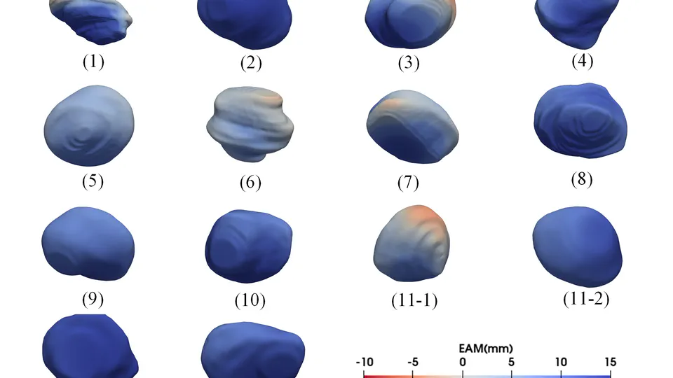 3D US-Based Evaluation and Optimization of Tumor Coverage for US-Guided Percutaneous Liver Thermal Ablation