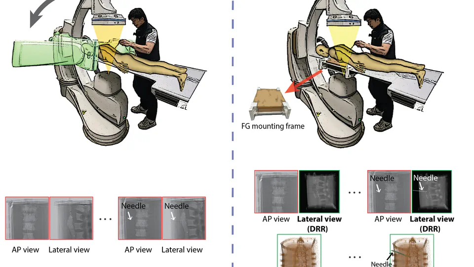 Towards Seamless Integration of Magnetic Tracking into Fluoroscopy-guided Interventions