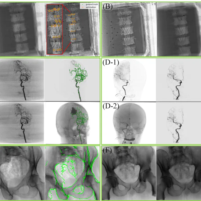 Seamless Integration of Magnetic Tracking