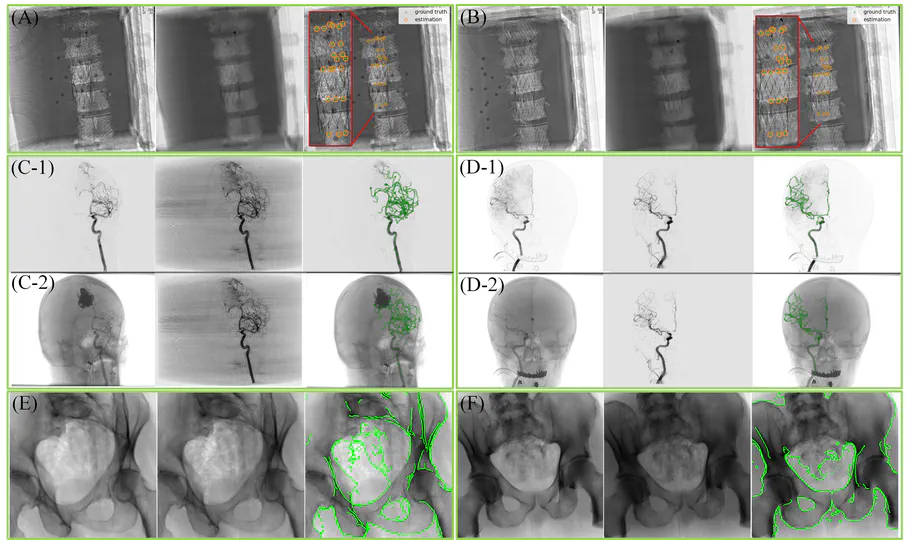 Seamless Integration of Magnetic Tracking