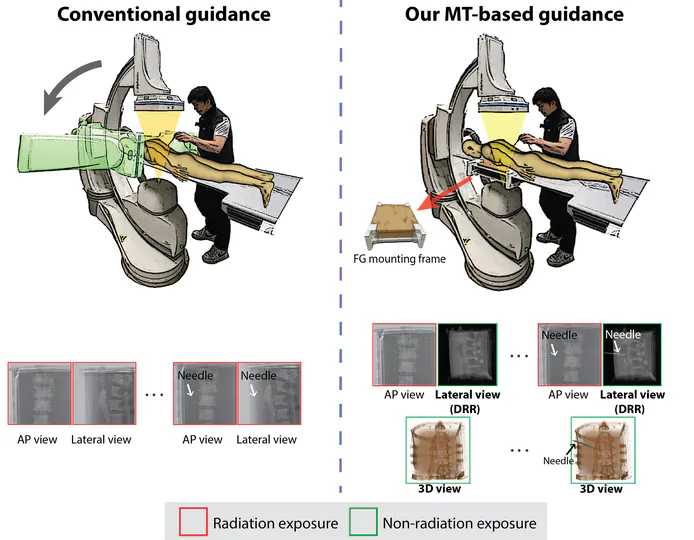 Virtual Fluoroscopy using Magnetic Tracking