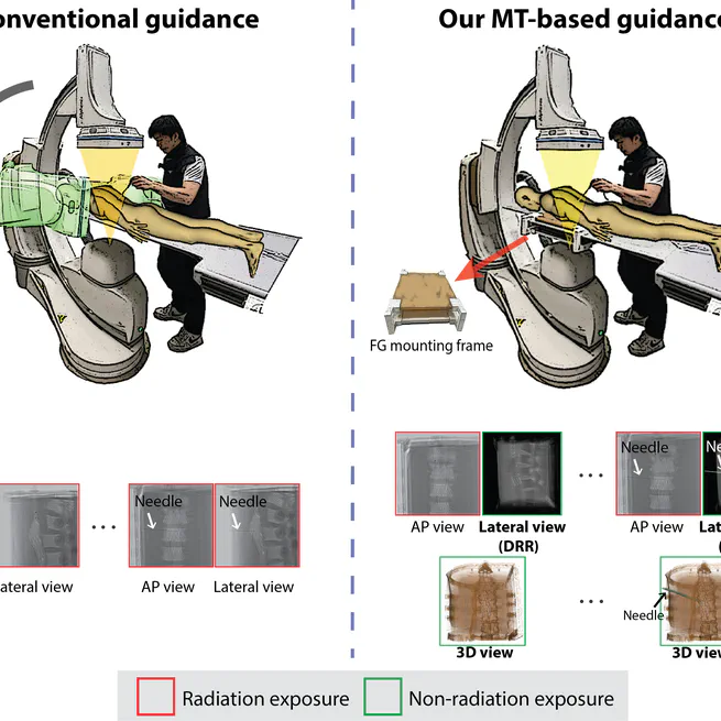 Virtual Fluoroscopy using Magnetic Tracking