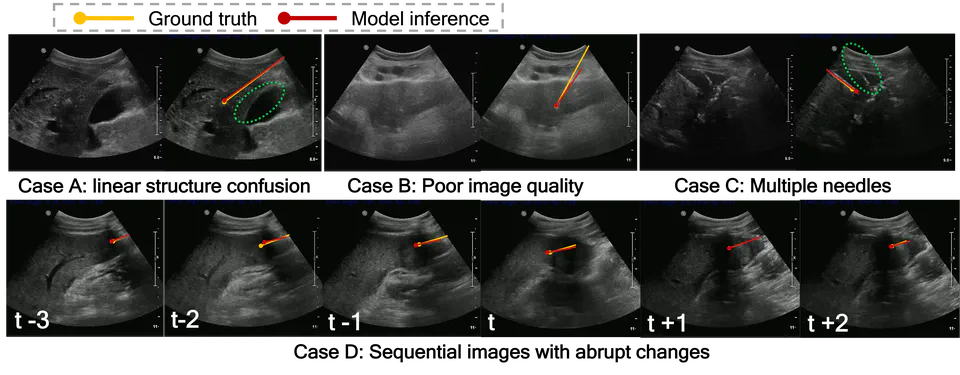 Needle Identification