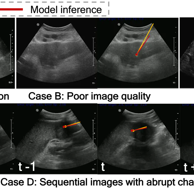 Needle Identification